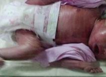 基础卵泡少1-3个能做试管吗？