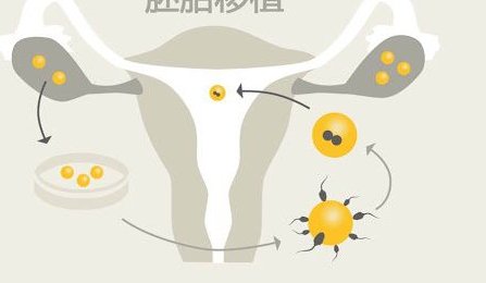 广东省湛江市知名的三大助孕中心是哪几家？这些都是过来人的推荐